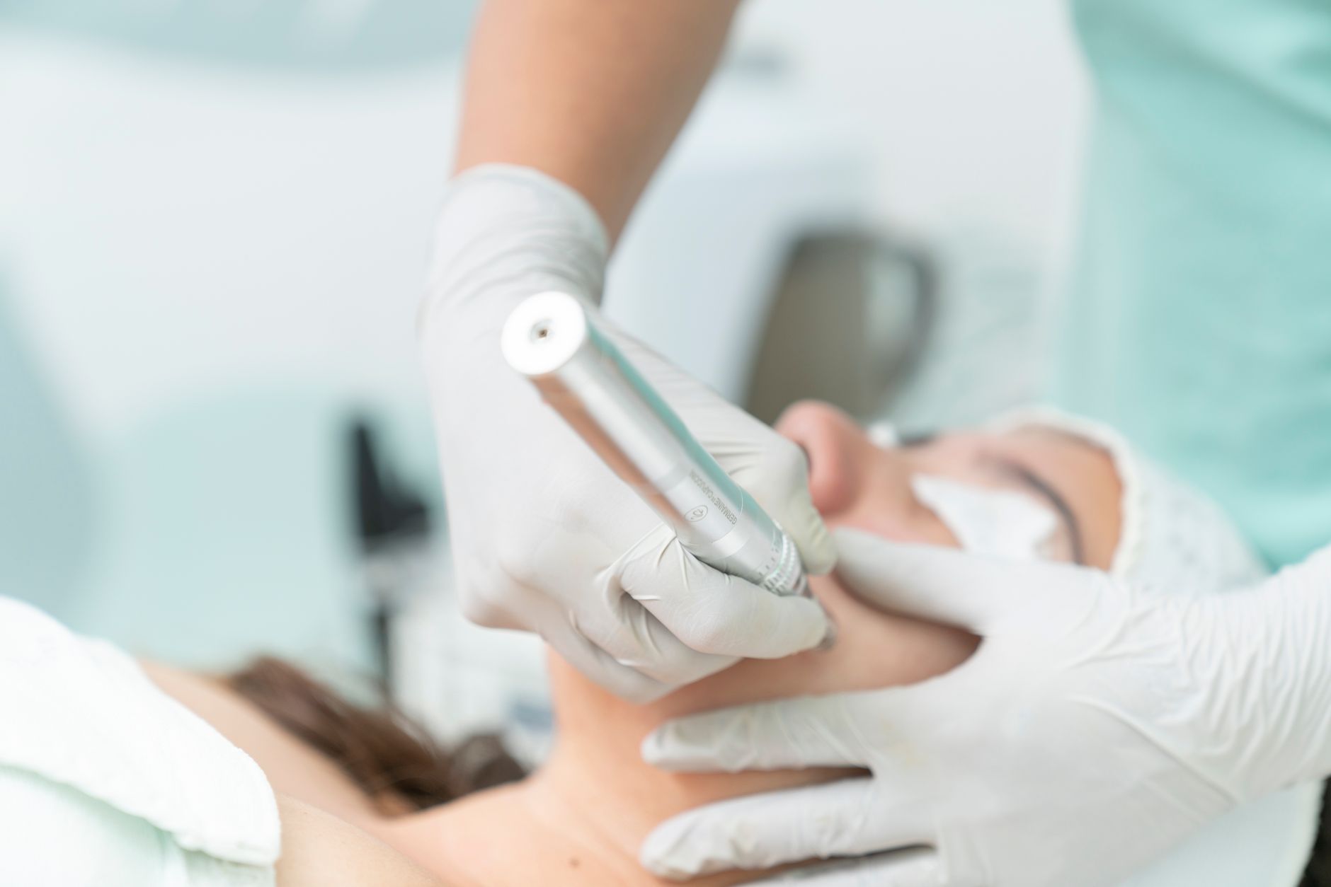 Microneedling s rastovými faktormi