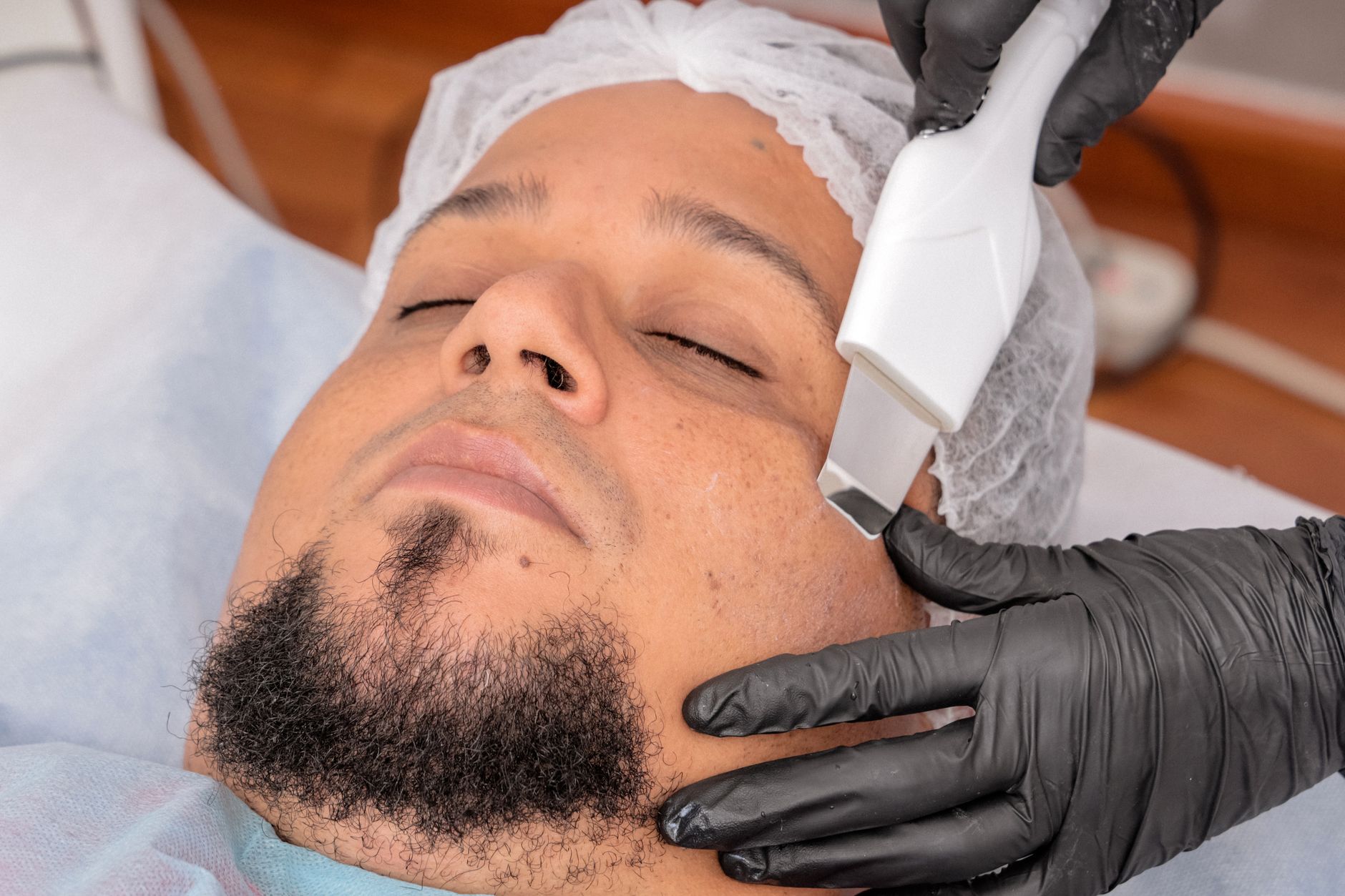 Chemický peeling AHA/BHA